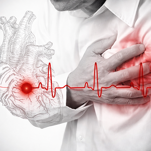 Enfermwiekes cardiovasculares